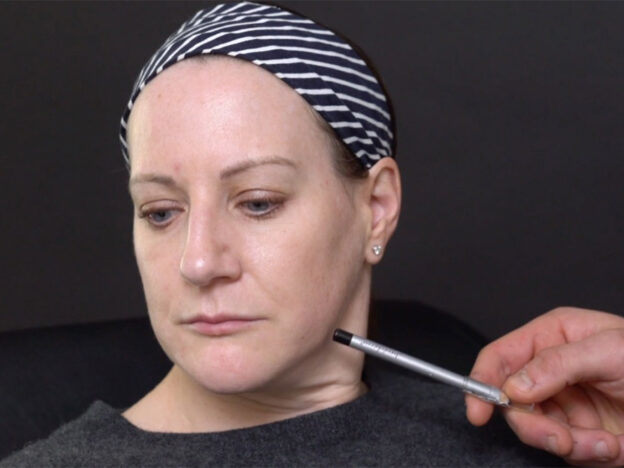 Advanced Dermal Fillers