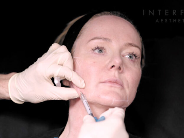 Biostimulators Masterclass - Biostimulator (HArmonyCa)