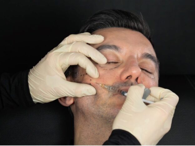 MD Codes Demonstration - Mid & Lower Face