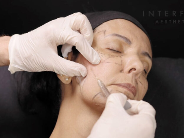 Masterclass - Full Face & Biostimulator (Female)