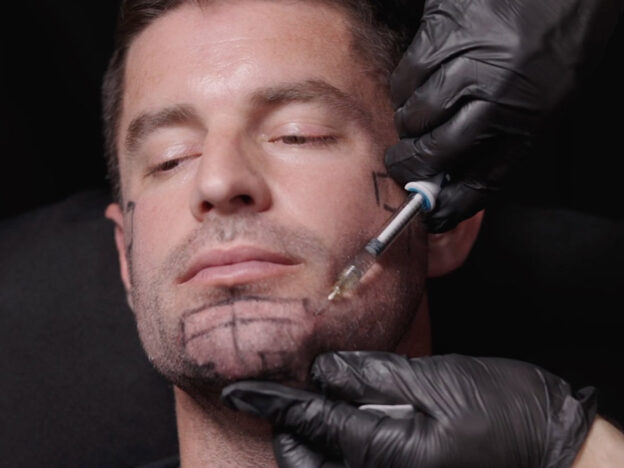 Masterclass - Mid & Lower Face & Biostimulator (Male - session 2)
