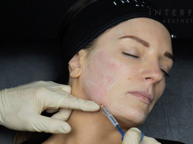 Masterclass - Full Face & Perioral Beautification (Female)
