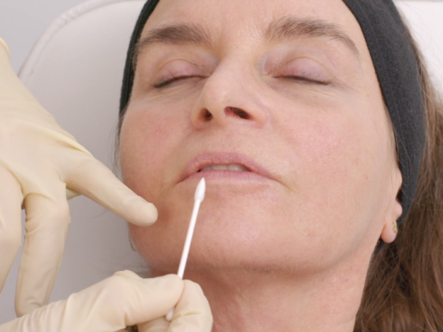 Carla Elective Lip Dissolving - Assessment