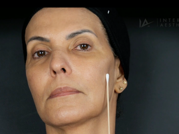 Nalva Lower Face Toxin & Lips