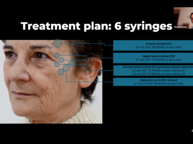 'A Plastic Surgeon's Approach to Injectables' - Dr Nicola Kefalas